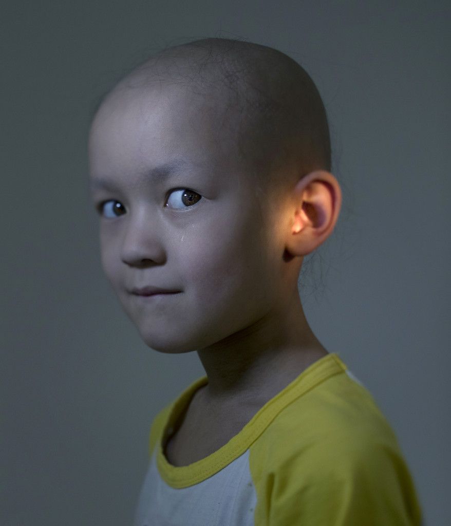Bildreportage om barncancer.
Maja, 5 år. Strålas för tumör i örat
